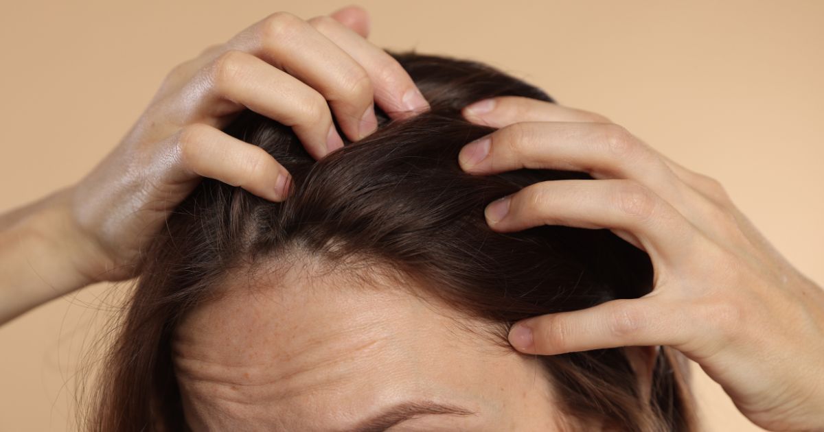 Preview_Article Blogue Phyto Canada pellicules